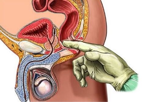 Massage de la prostate